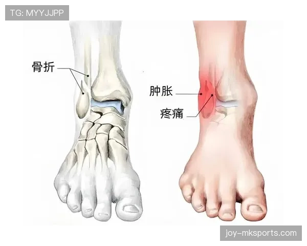 从争议视角解析违体犯规的判罚标准，如何准确认定球场上的危险动作？